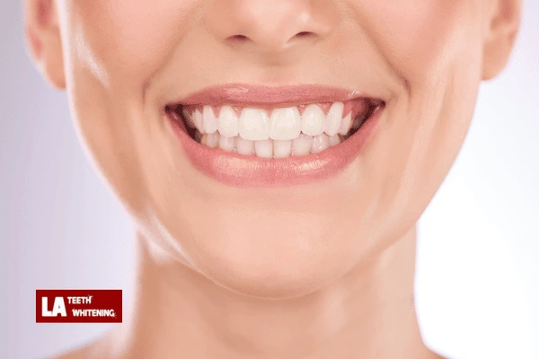 Can Laser Whitening Be Combined with Home Maintenance for Extra Brightness Littlehampton