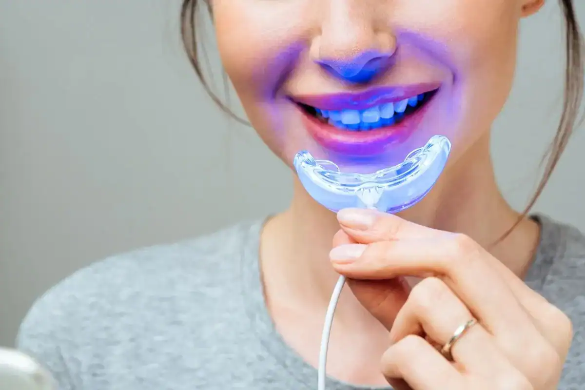 Can Laser Whitening Correct Deep or Intrinsic Discolouration Littlehampton