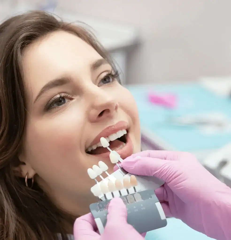 Can Laser Whitening Be Done on Teeth with Fillings or Crown Littlehampton